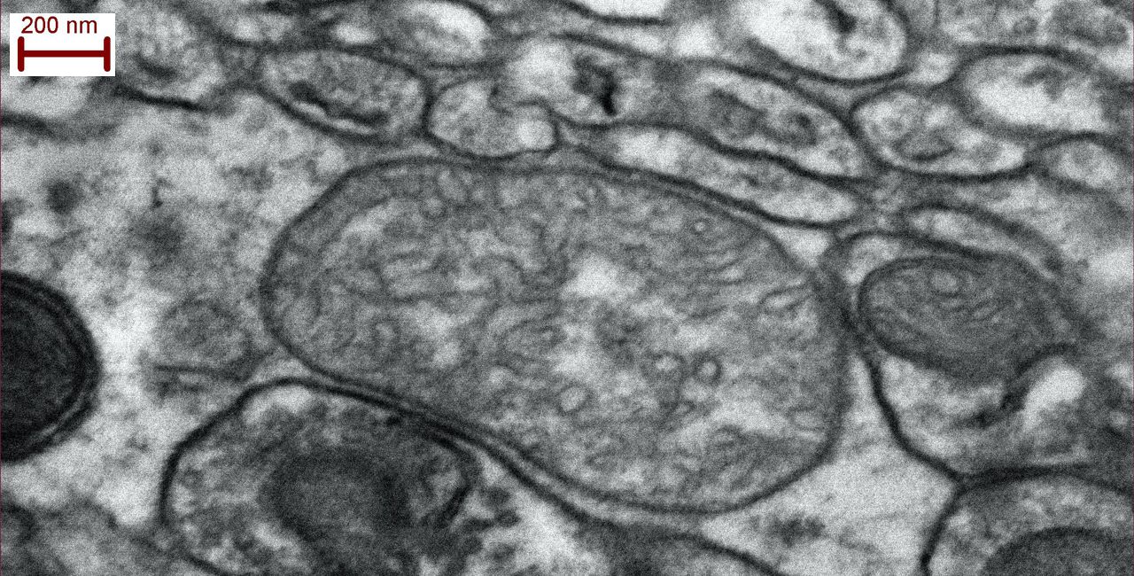 Mouse nerve cells observed with STEM detector