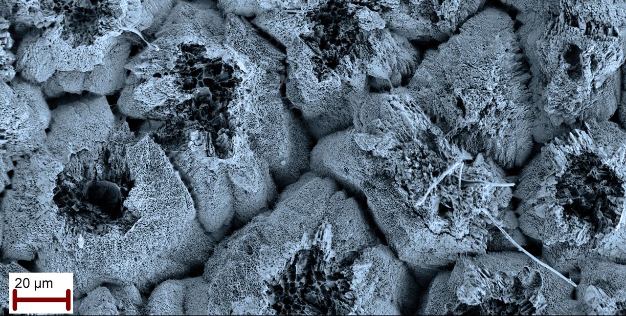 Calcium carbonate (calcite) crystals growing from nucleation centers in eggshell of a robin