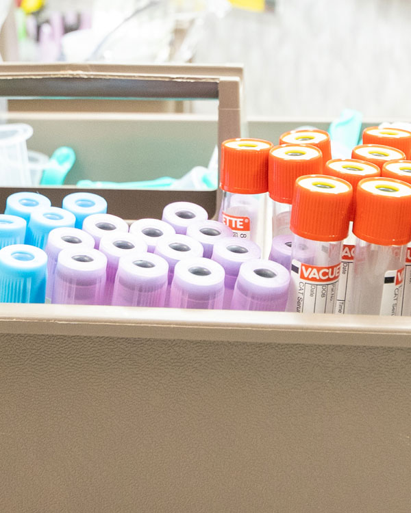 speciman containers in a medical laboratory.